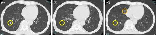 Details are in the caption following the image Details are in the caption following the image