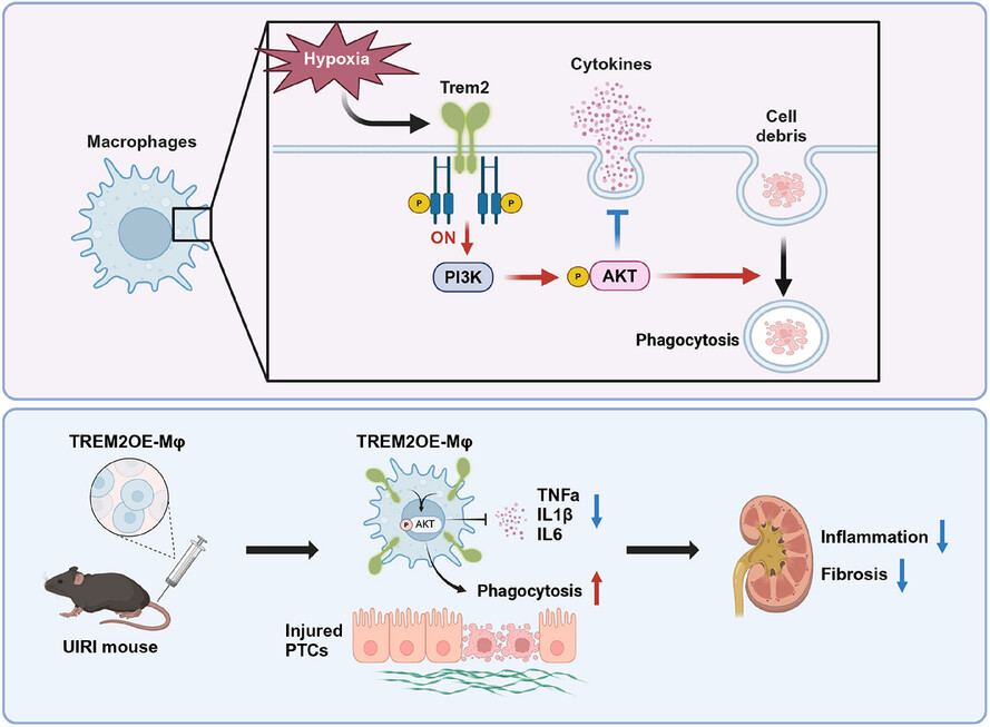 An adoptive cell therapy with TREM2-overexpressing macrophages mitigates the transition from acute kidney injury to chronic kidney disease
