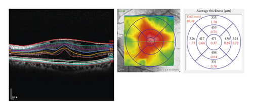 Details are in the caption following the image Details are in the caption following the image