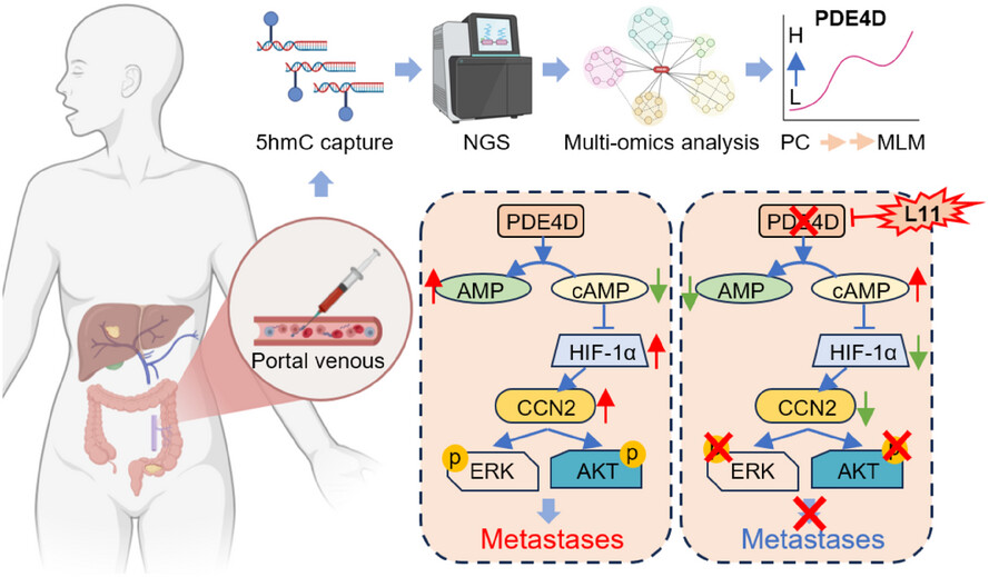 5-hydroxymethylcytosine features of portal venous blood predict metachronous liver metastases of colorectal cancer and reveal phosphodiesterase 4 as a therapeutic target