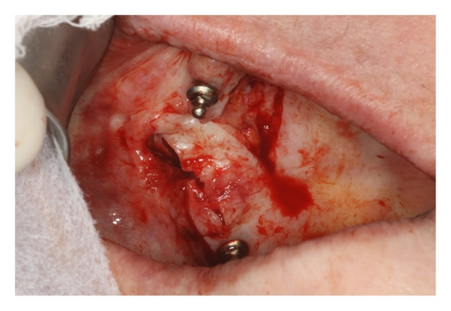 Details are in the caption following the image Details are in the caption following the image