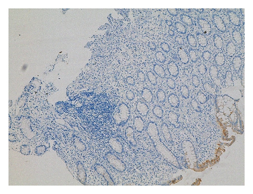 Details are in the caption following the image