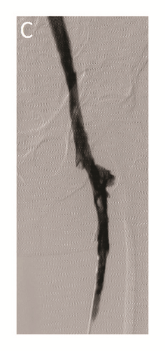 Details are in the caption following the image