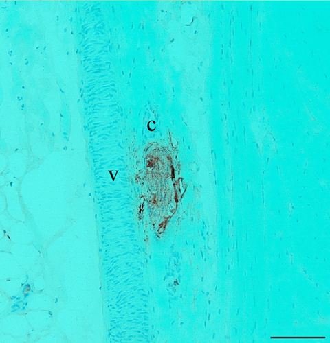 Details are in the caption following the image