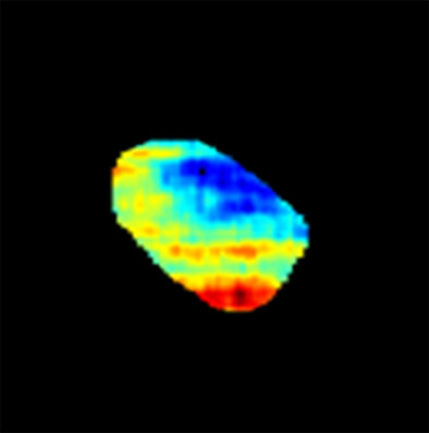 Use of photoacoustic imaging for monitoring vascular disrupting cancer treatments