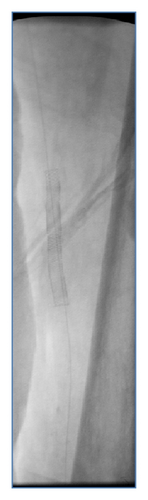 Details are in the caption following the image