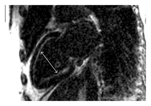 Details are in the caption following the image