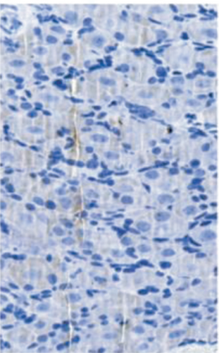 Details are in the caption following the image