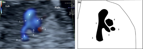 Details are in the caption following the image