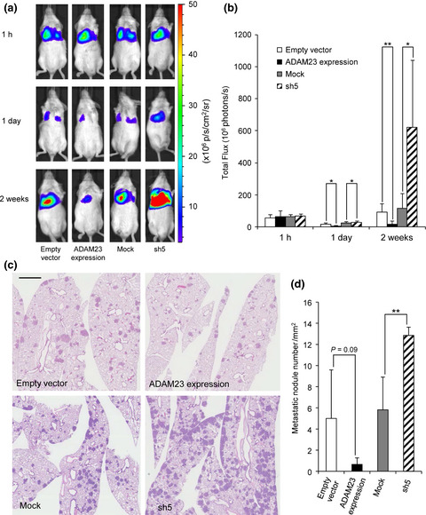 ADAM23 is downregulated in side population and suppresses lung metastasis of lung carcinoma cells