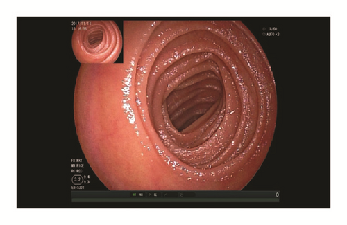 Details are in the caption following the image Details are in the caption following the image