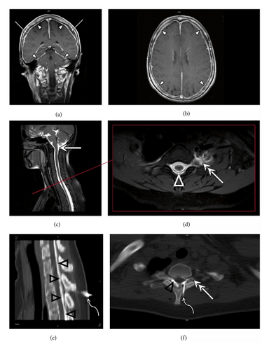 Details are in the caption following the image Details are in the caption following the image