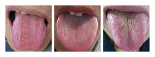 Details are in the caption following the image Details are in the caption following the image