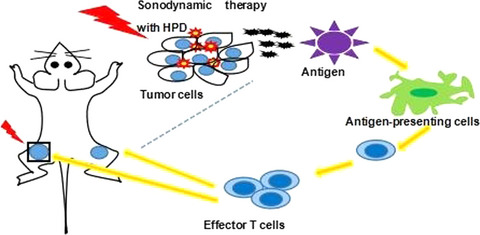 Sonodynamic therapy-assisted immunotherapy: A novel modality for cancer treatment