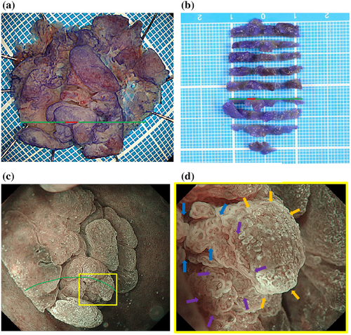 Details are in the caption following the image Details are in the caption following the image