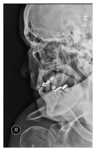 Details are in the caption following the image
