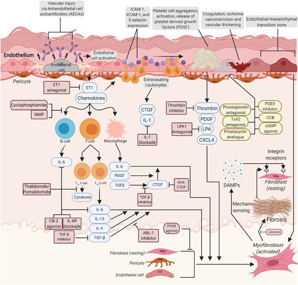 Upcoming treatments for morphea