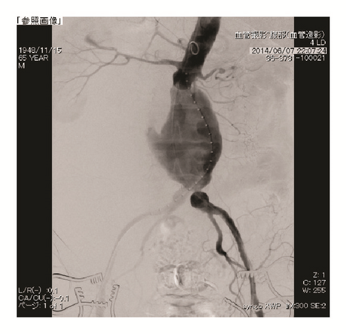 Details are in the caption following the image Details are in the caption following the image