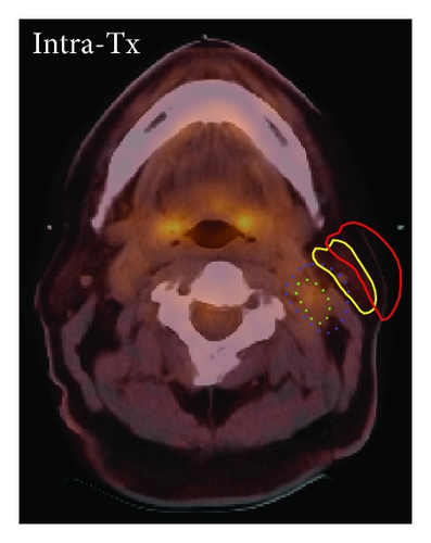 Details are in the caption following the image Details are in the caption following the image