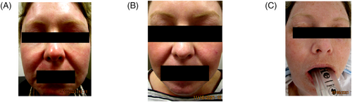 Details are in the caption following the image Details are in the caption following the image