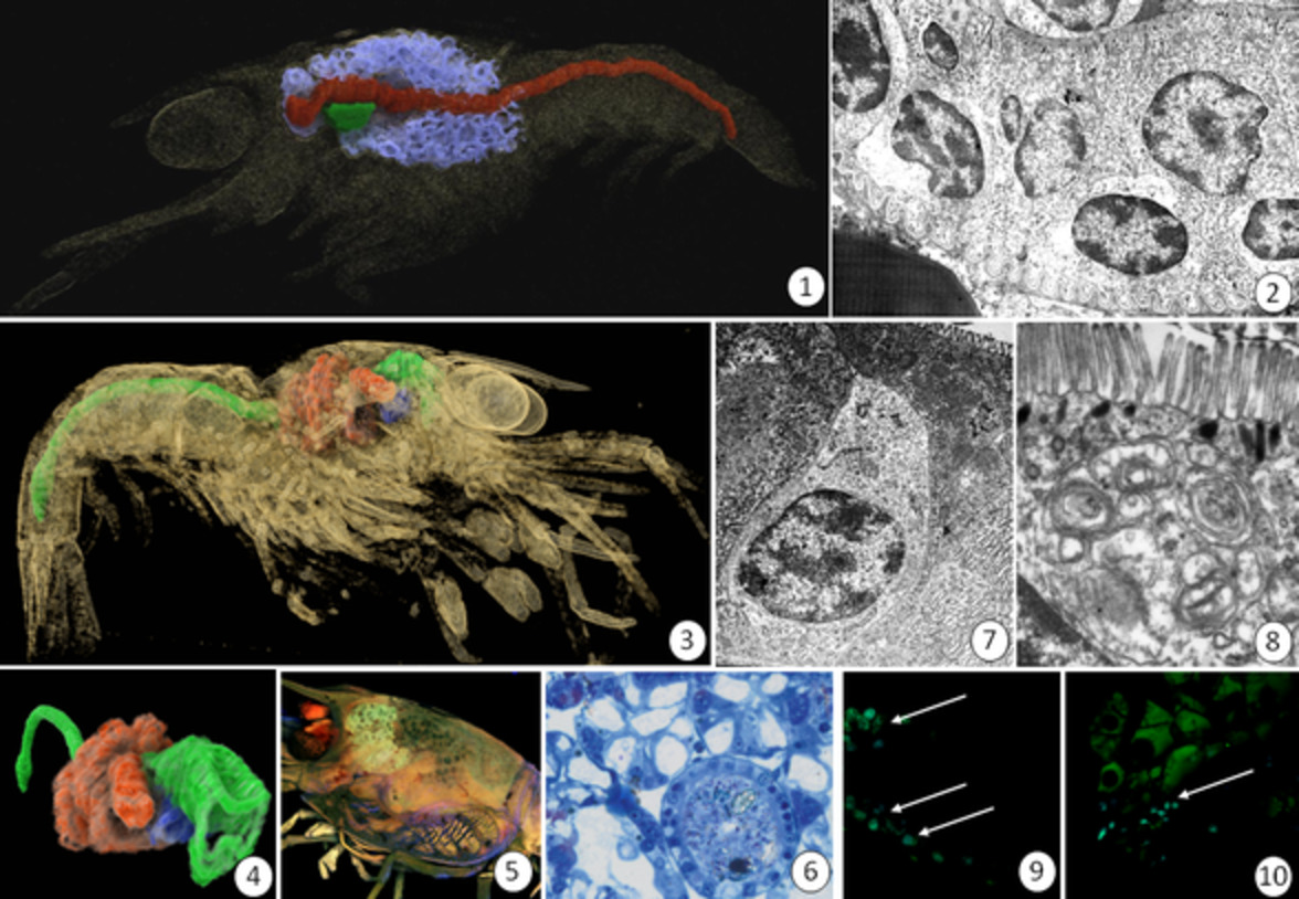 Postembryonic development and differentiation of the midgut in the freshwater shrimp Neocaridina davidi (Crustacea, Malacostraca, Decapoda) larvae