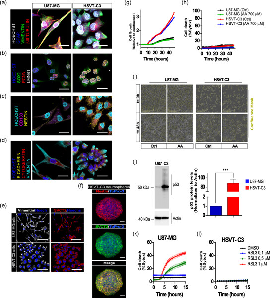 Vitamin C deficient reduces proliferation in a human periventricular tumor stem cell-derived glioblastoma model