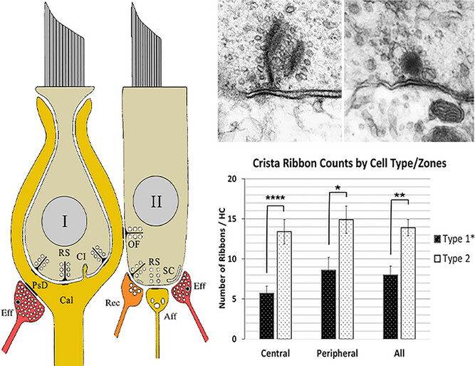 A Regional Ultrastructural Analysis of the Cellular and Synaptic Architecture of the Mouse Vestibular Periphery, With Reference to the Chinchilla Issue 7, 2025