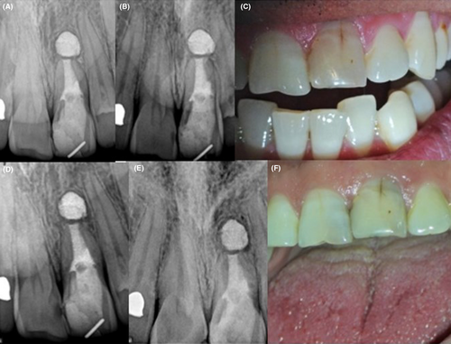 Details are in the caption following the image Details are in the caption following the image