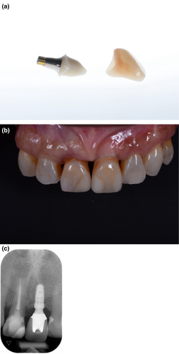 Details are in the caption following the image Details are in the caption following the image