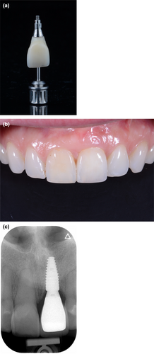 Details are in the caption following the image Details are in the caption following the image