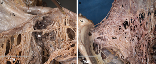 Details are in the caption following the image