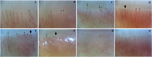 Details are in the caption following the image Details are in the caption following the image