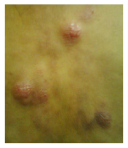 Details are in the caption following the image