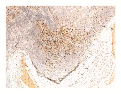Details are in the caption following the image