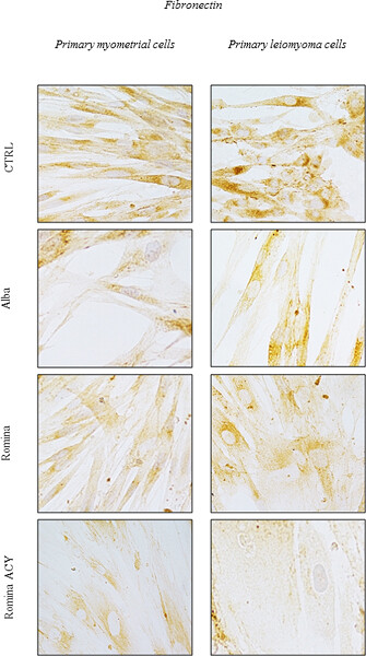Romina: A powerful strawberry with in vitro efficacy against uterine leiomyoma cells