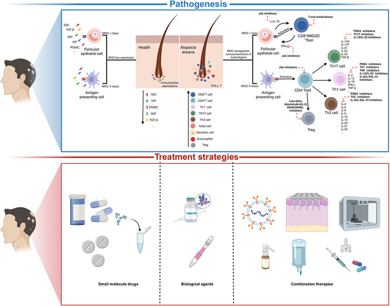 Alopecia Areata: Pathogenesis, Diagnosis, and Therapies