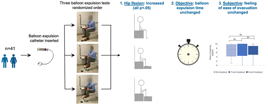 Using a footstool does not aid simulated defecation in undifferentiated constipation: A randomized trial