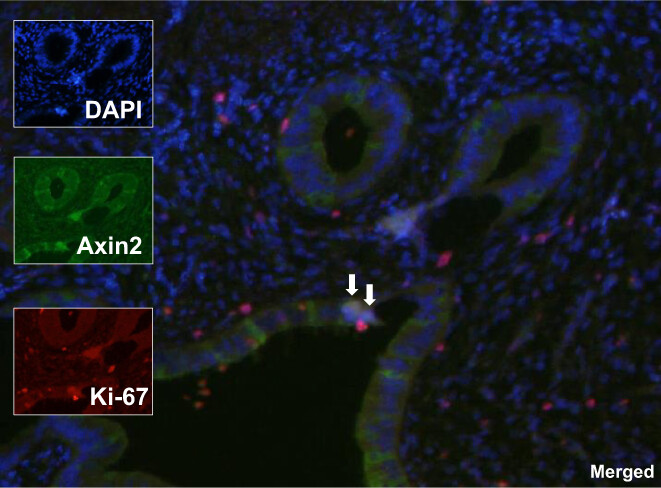 Frequent PIK3CA mutation in normal endometrial gland drives spheroid formation and may be involved in stem cell propagation
