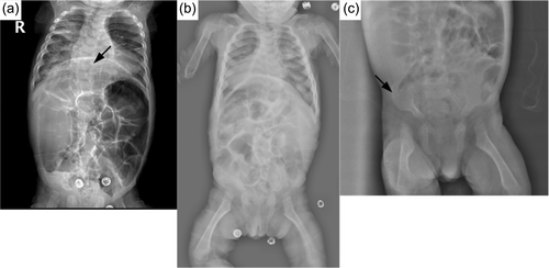 Details are in the caption following the image Details are in the caption following the image