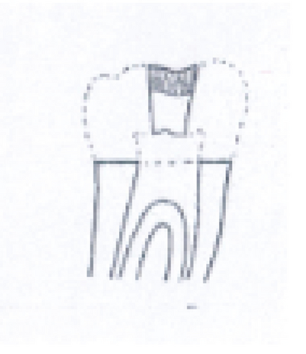 Details are in the caption following the image