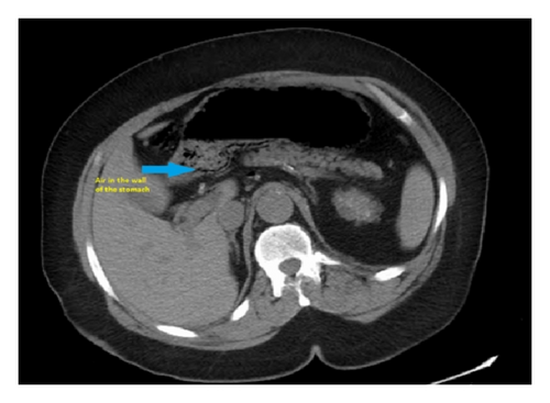 Details are in the caption following the image Details are in the caption following the image