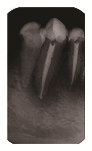 Details are in the caption following the image