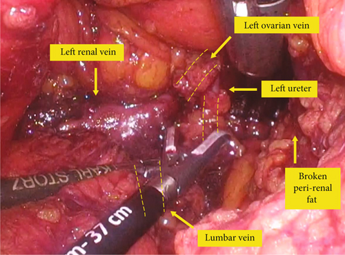 Details are in the caption following the image Details are in the caption following the image