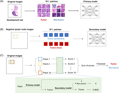 Diagnosis of lymph node metastasis in head and neck squamous cell carcinoma using deep learning