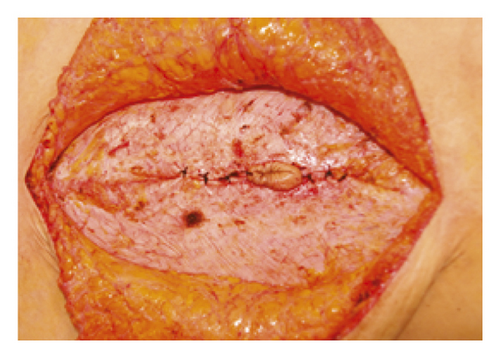 Details are in the caption following the image Details are in the caption following the image