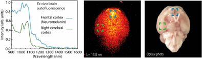 The near-infrared autofluorescence fingerprint of the brain
