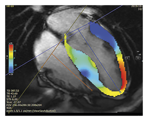 Details are in the caption following the image Details are in the caption following the image