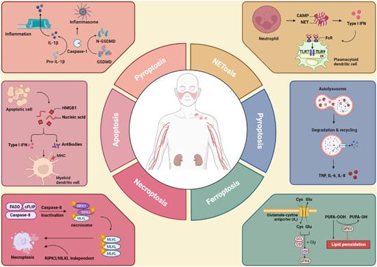Unveiling the nexus: Decoding interactions between regulated cell death and systemic lupus erythematosus pathogenesis for innovative therapeutic avenues