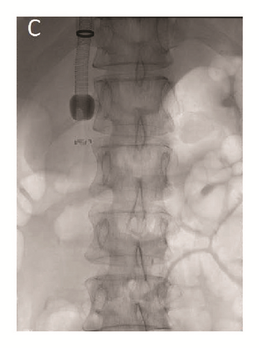 Details are in the caption following the image