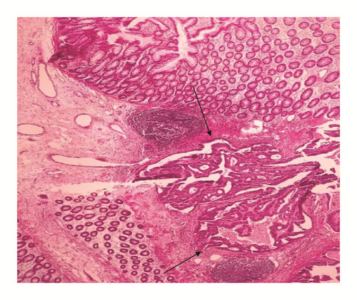 Details are in the caption following the image Details are in the caption following the image